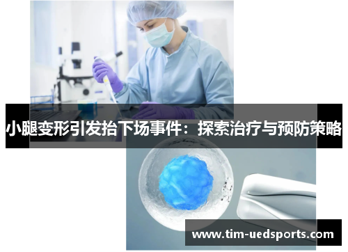 小腿变形引发抬下场事件:探索治疗与预防策略 小腿变形引发抬下场事件:探索治疗与预防策略